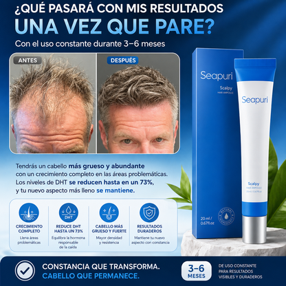 CapiLuxe™ | Reactiva tu crecimiento capilar