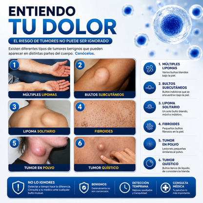South Moon | Spray Removedor de Lipomas