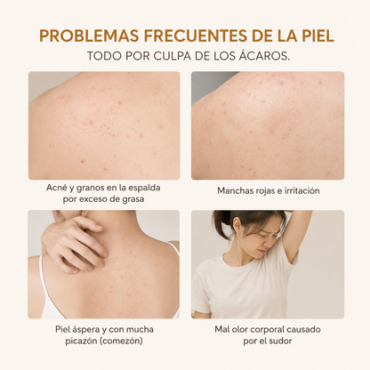 Quarxery™ | Gel Acne | Ayuda a combatir imperfecciones