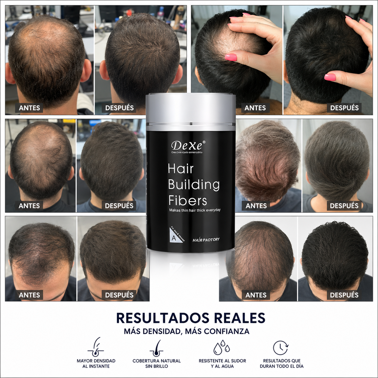 Dexe™ | Relleno para aumentar la densidad capilar