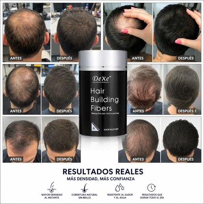 Dexe™ | Relleno para aumentar la densidad capilar