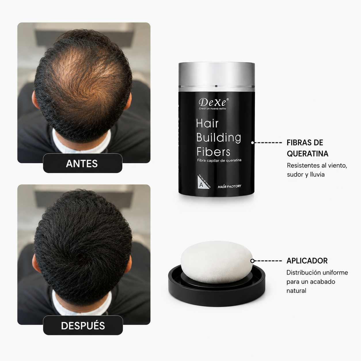 Dexe™ | Relleno para aumentar la densidad capilar
