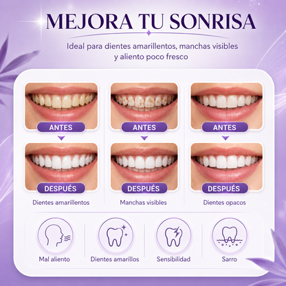 Hismile™ | Sérum Corrector de Color V34 | Brillo Instantáneo para tus Dientes