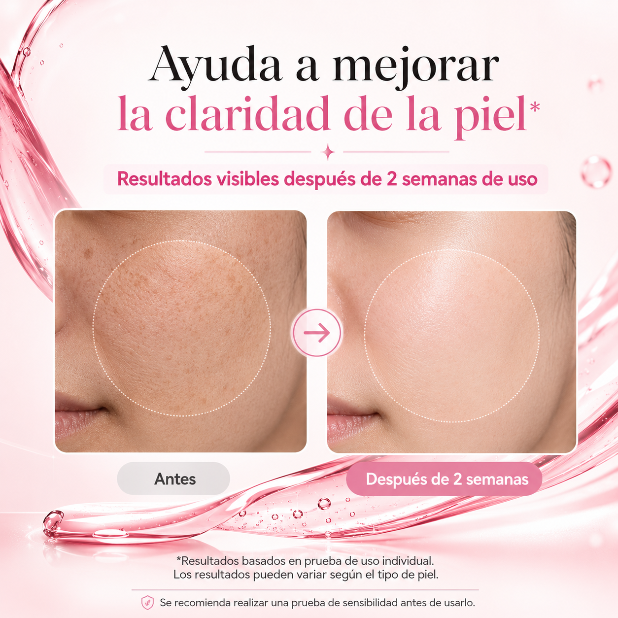 Anua™  | Sérum Niacinamida | Aclara manchas