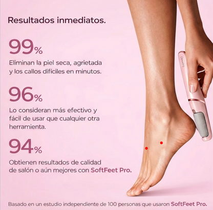 SoftFeet Pro – Callus Remover